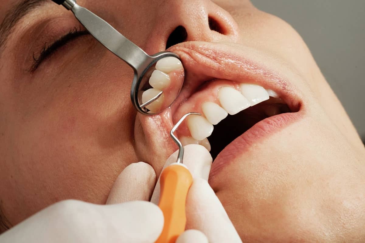 Signs Of A Dental Emergency That You Shouldn’t Ignore